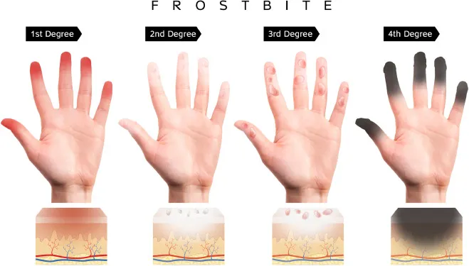 Hands